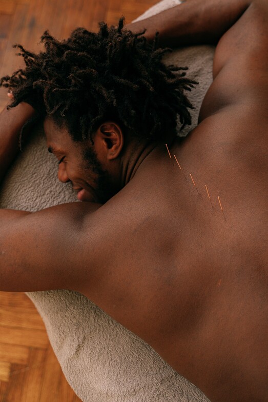dry needling